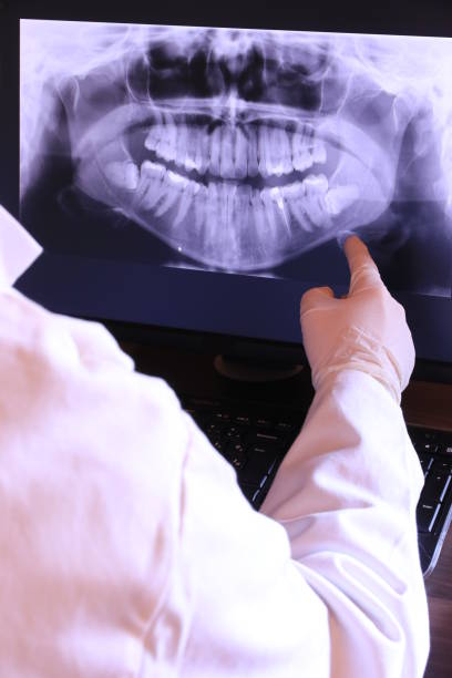 Best Emergency Tooth Extraction in Kingston, NY